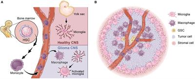 Immune Microenvironment in Glioblastoma Subtypes